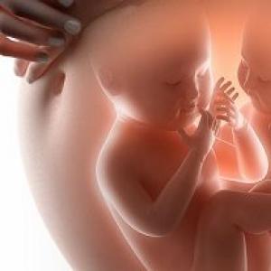 Complications during pregnancy: what are they, their causes, risk groups Manifestations of pregnancy complications and measures to be taken if they occur