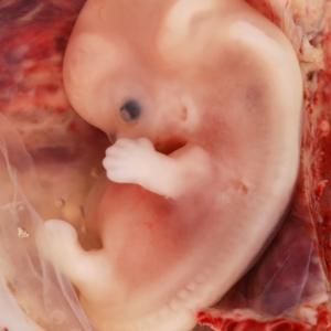 गर्भधारणेची पहिली चिन्हे गर्भवती असल्यास लक्षणे